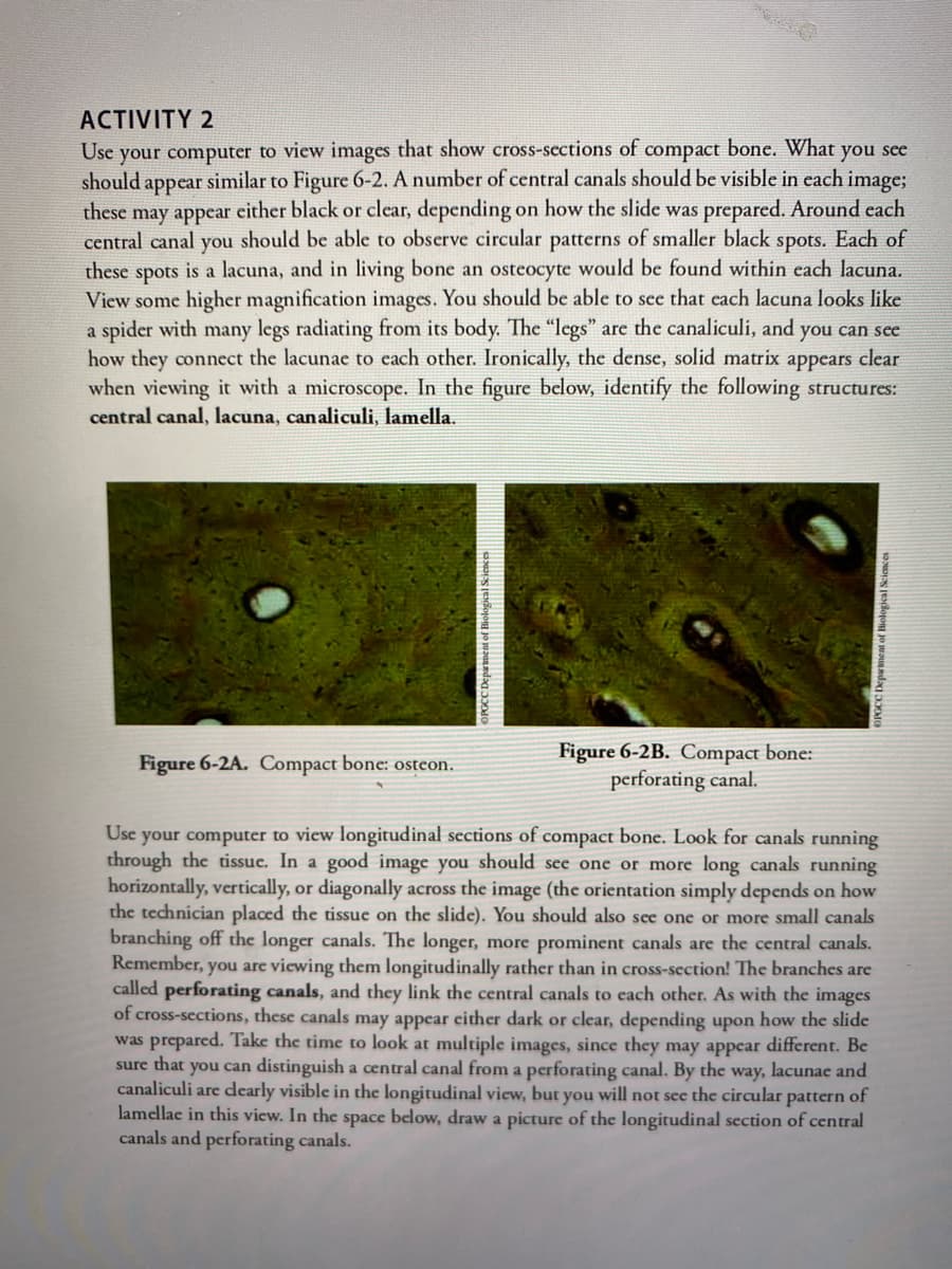 ACTIVITY 2
your computer to view images that show cross-sections of
should appear similar to Figure 6-2. A number of central canals should be visible in each image;
Use
compact
bone. What you see
these
either black or clear, depending
on how the slide was prepared. Around cach
may appear
central canal you should be able to observe circular patterns of smaller black spots. Each of
spots is a lacuna, and in living bone an osteocyte would be found within each lacuna.
View some higher magnification images. You should be able to sce that each lacuna looks like
a spider with many legs radiating from its body. The "legs" are the canaliculi, and you can sce
how they connect the lacunae to cach other. Ironically, the dense, solid matrix appears clear
when viewing it with a microscope. In the figure below, identify the following structures:
these
central canal, lacuna, canaliculi, lamella.
Figure 6-2B. Compact bone:
perforating canal.
Figure 6-2A. Compact bone: osteon.
Use your computer to view longitudinal sections of compact bone. Look for canals running
through the tissue. In a good image you should see one or more long canals running
horizontally, vertically, or diagonally across the image (the orientation simply depends on how
the technician placed the tissue on the slide). You should also see one or more small canals
branching off the longer canals. The longer, more prominent canals are the central canals.
Remember, you are viewing them longitudinally rather than in cross-section! The branches are
called perforating canals, and they link the central canals to cach other. As with the images
of cross-sections, these canals may appear either dark or clear, depending upon how the slide
was prepared. Take the time to look at multiple images, since they may appear different. Be
sure that you can distinguish a central canal from a perforating canal. By the way, lacunae and
canaliculi are dearly visible in the longitudinal view, but you will not see the circular pattern of
lamellae in this view. In the space below, draw a picture of the longitudinal section of central
canals and perforating canals.
OPGCC Department of Biological Scicnces
Biological Sciences
