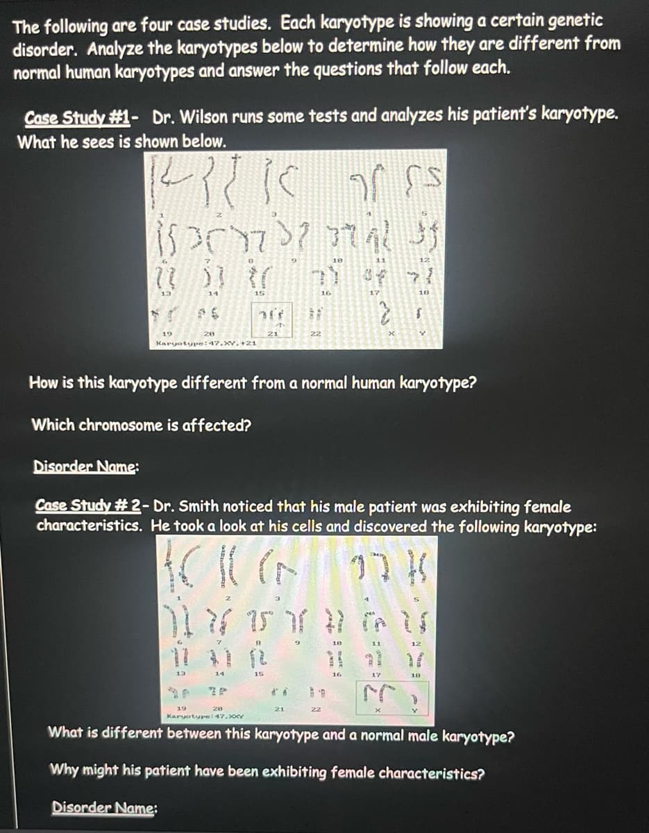 The following are four case studies. Each karyotype is showing a certain genetic
disorder. Analyze the karyotypes below to determine how they are different from
normal human karyotypes and answer the questions that follow each.
Case Study #1- Dr. Wilson runs some tests and analyzes his patient's karyotype.
What he sees is shown below.
142215
ISPOD? AL
11
Disorder Name:
71 ))
14
P.S
28
Karyotype: 47.XY, +21
13
19
8
How is this karyotype different from a normal human karyotype?
Which chromosome is affected?
ܐ
3ff
14
Case Study #2- Dr. Smith noticed that his male patient was exhibiting female
characteristics. He took a look at his cells and discovered the following karyotype:
ACKG
27 K
28
17 15 7 # GUS
Y
18
22
A
12
15
21
2
12
B
18
22
11
HY
17
12
18
Karyotype:47, XXXY
What is different between this karyotype and a normal male karyotype?
Why might his patient have been exhibiting female characteristics?
Disorder Name: