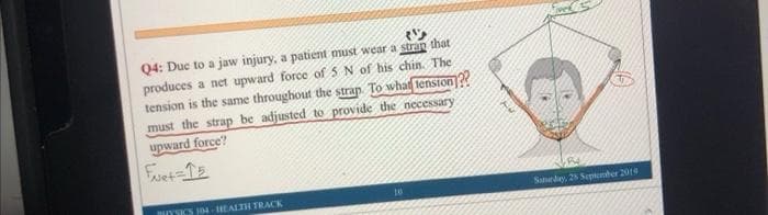 Q4: Duc to a jaw injury, a patient must wear a stran that
produces a net upward force of 5 N of his chin. The
tension is the same throughout the strap. To what lenston|??
must the strap be adjusted to provide the necessary
upward force?
Fuet=1E
BYSICS 104 HEALTH TRACK
10
Saurday, 25 Septber 2010
