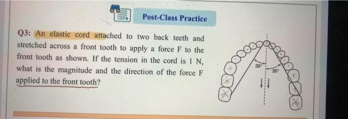 Post-Class Practice
Q3: An elastic cord attached to two back teeth and
stretched across a front tooth to apply a force F to the
front tooth as shown. If the tension in the cord is 1 N,
what is the magnitude and the direction of the force F
applied to the front tooth?
