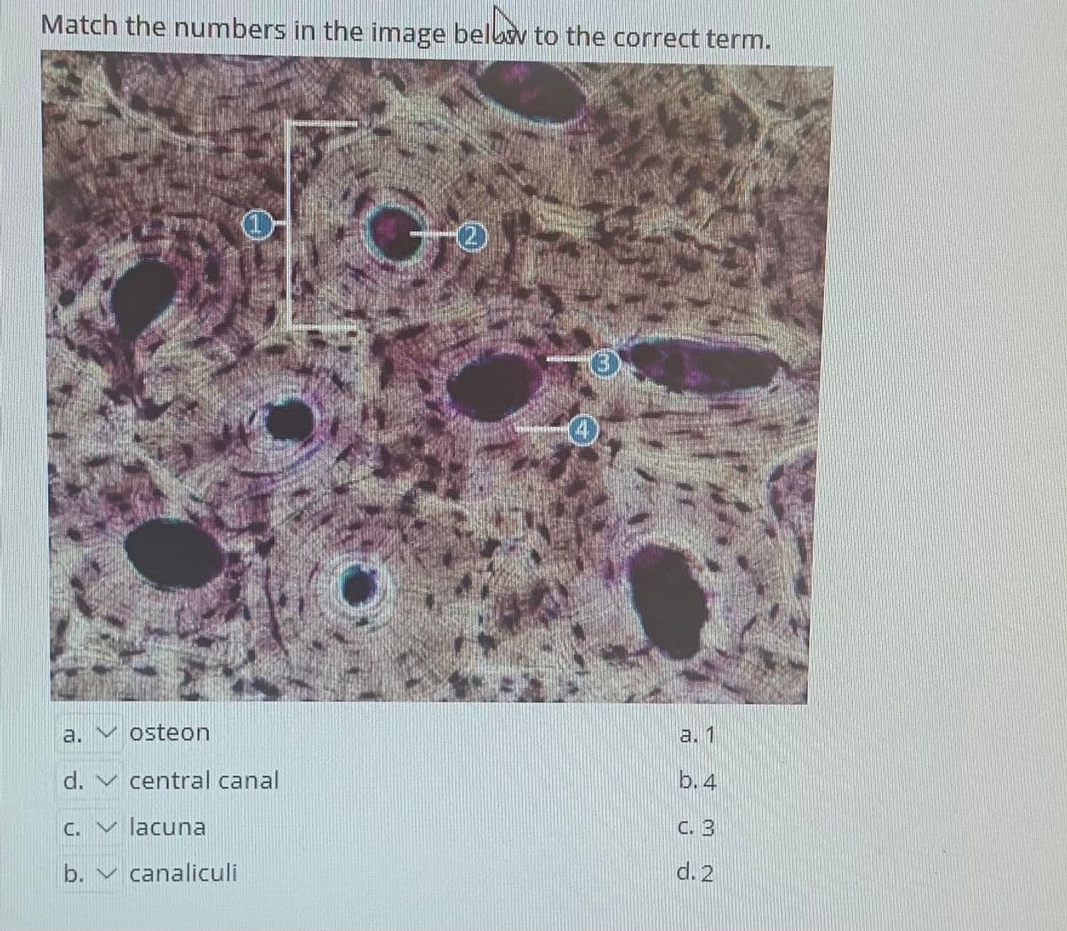 Match the numbers in the image belbv to the correct term.
(2)
(3
a. V osteon
a. 1
d. v central canal
b. 4
C. v lacuna
C. 3
b. v canaliculi
d. 2
