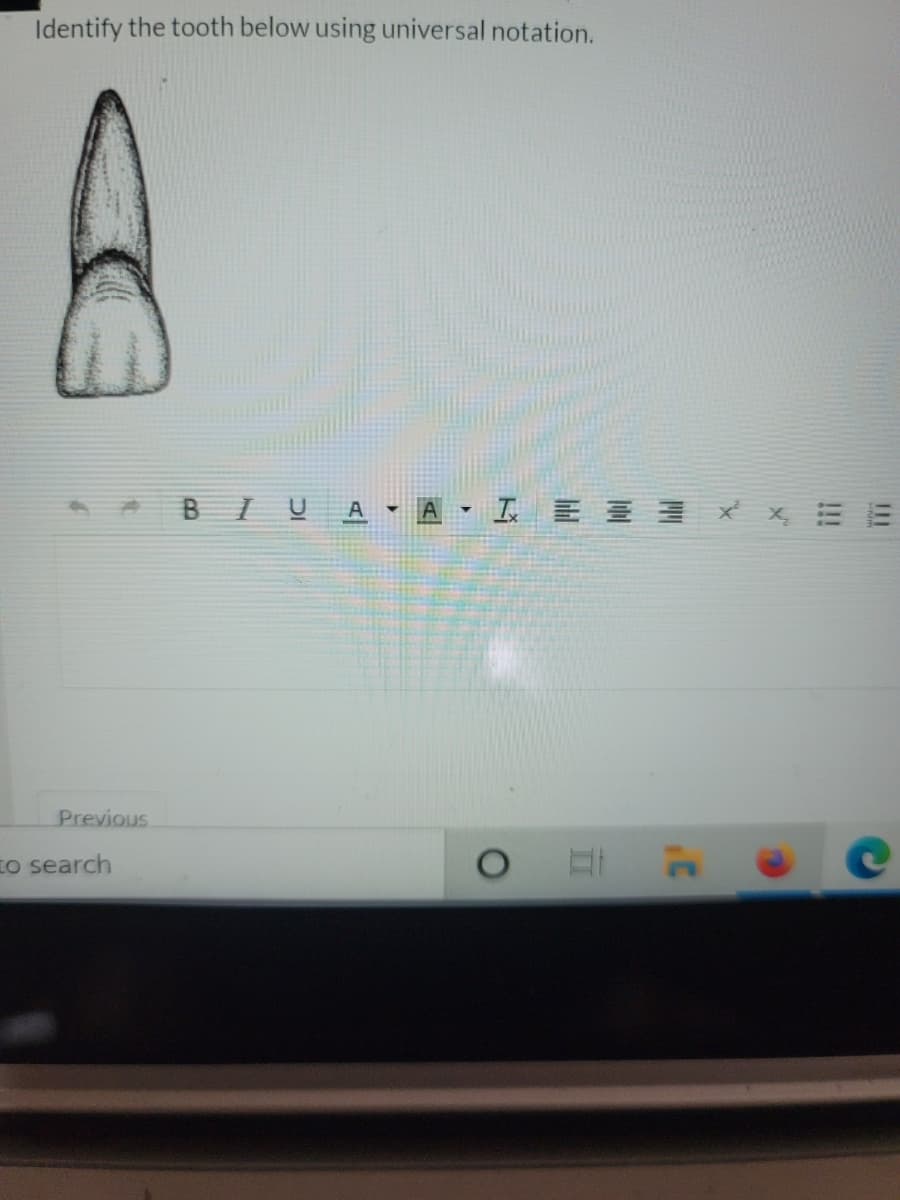 Identify the tooth below using universal notation.
A
BIU
스-A. I x x E
Previous
to search
