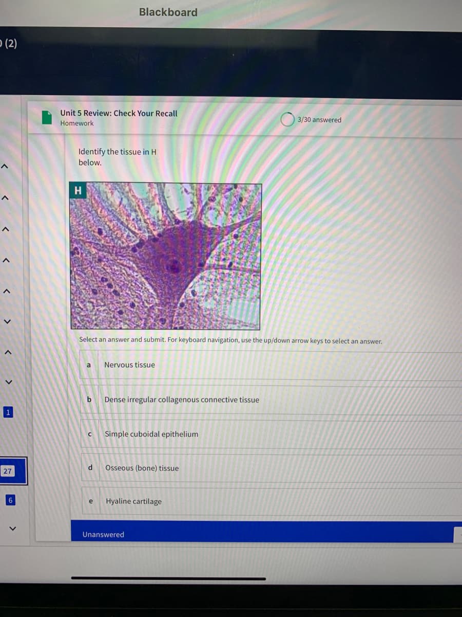 Blackboard
P (2)
Unit 5 Review: Check Your Recall
3/30 answered
Homework
Identify the tissue in H
below.
H
Select an answer and submit. For keyboard navigation, use the up/down arrow keys to select an answer.
a
Nervous tissue
b
Dense irregular collagenous connective tissue
Simple cuboidal epithelium
Osseous (bone) tissue
27
Hyaline cartilage
Unanswered
>
