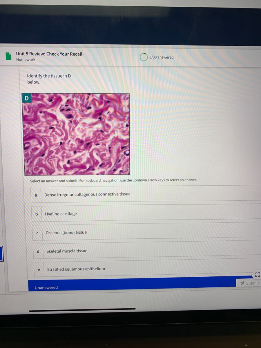 Unit 5 Review: Check Your Recall
3/30 answered
Homework
Identify the tissue in D
below.
Select an answer and submit. For keyboard navigation, use the up/down arrow keys to select an answer.
Dense irregular collagenous connective tissue
a
b
Hyaline cartilage
Osseous (bone) tissue
d
Skeletal muscle tissue
e
Stratified squamous epithelium
A Submit
Unanswered
