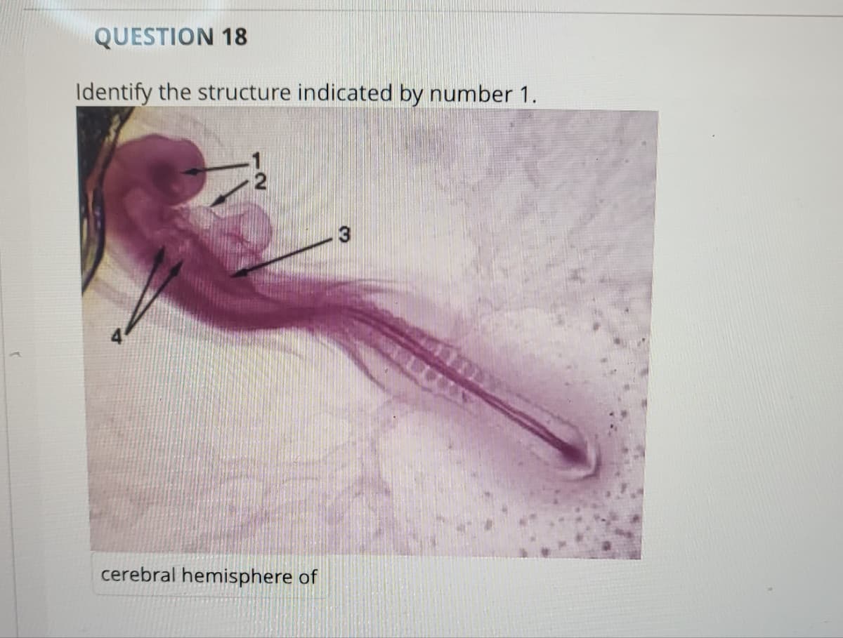 QUESTION 18
Identify the structure indicated by number 1.
2
cerebral hemisphere of
3