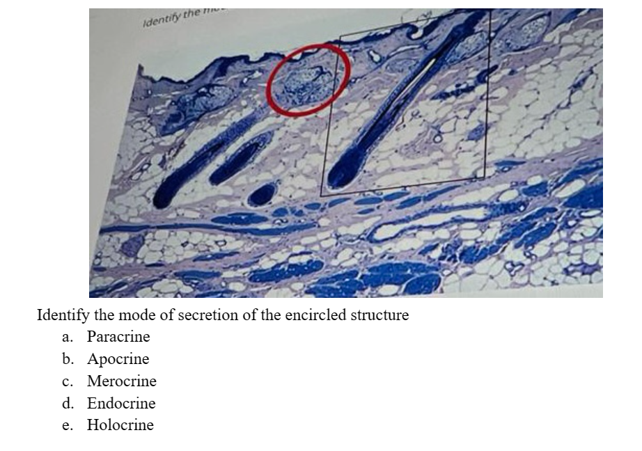 Identify the me
Identify the mode of secretion of the encircled structure
a. Paracrine
b. Apocrine
c. Merocrine
d. Endocrine
e. Holocrine