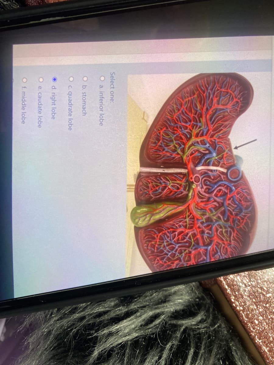 Select one:
O a. inferior lobe
O b. stomach
Oc. quadrate lobe
O d. right lobe
O e. caudate lobe
O f. middle lobe
