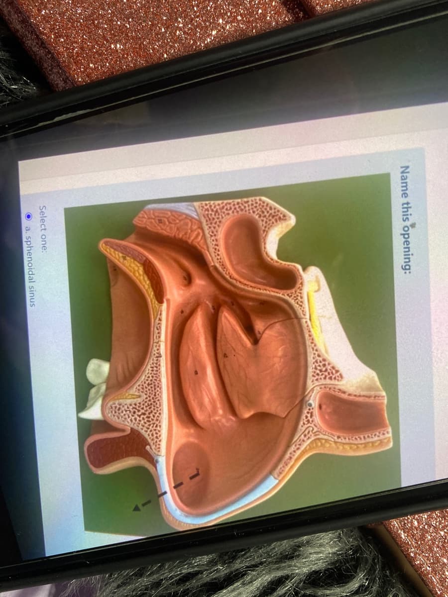 Name this opening:
Select one:
O a. sphenoidal sinus
