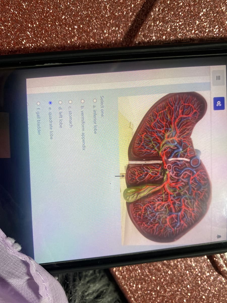 II
Select one:
O a. inferior lobe
O b. vermiform appendix
Oc. stomach
O d. left lobe
e quadrate lobe
O f. gall bladder
