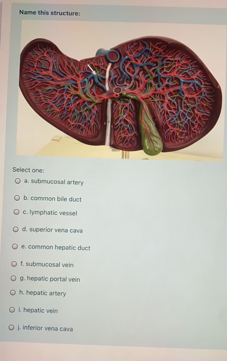 Name this structure:
Select one:
O a. submucosal artery
O b. common bile duct
O c. lymphatic vessel
O d. superior vena cava
O e. common hepatic duct
O f. submucosal vein
O g. hepatic portal vein
O h. hepatic artery
O i. hepatic vein
O j. inferior vena cava
