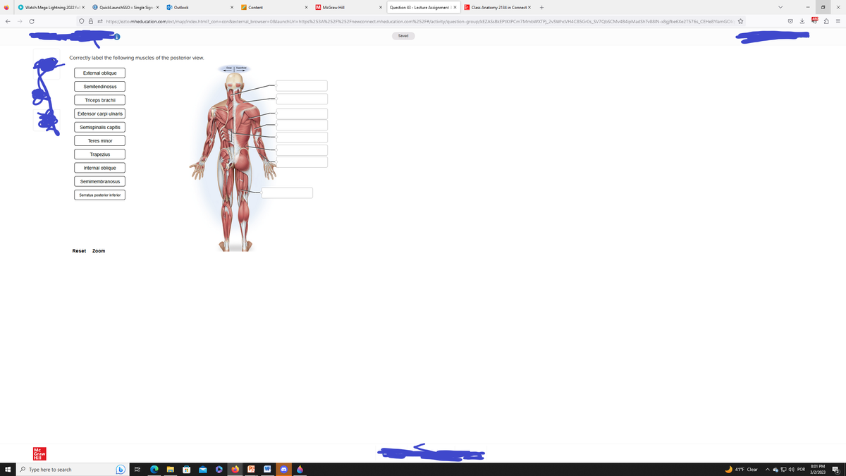 I
Watch Mega Lightning 2022 full X
QuickLaunchSSO :: Single Sign-X 0 Outlook
Mc
Graw
Hill
Type here to search
Correctly label the following muscles of the posterior view.
External oblique
Semitendinosus
ов https://ezto.mheducation.com/ext/map/index.html?_con=con&external_browser=0&launch Url=https%253A%252F%252Fnewconnect.mheducation.com%252F#/activity/question-group/kEZASSBkEPtKtPCm7MmbWXTPj_2vSWhcVH4C85Gr0s_SV7QbSCMv4B4ipMadShTv88IN-x8gjfbe6Xe2T576s_CEHe8YlamGOlc
Triceps brachii
Extensor carpi ulnaris
Semispinalis capitis
Teres minor
Trapezius
Internal oblique
Semimembranosus
Serratus posterior inferior
Reset Zoom
(2)
Hi
Content
Deep Superficial
M McGraw Hill
W B
Question 43 - Lecture Assignment 3 X
Saved
Class Anatomy 2134 in Connect X +
کے
41°F Clear
4) POR
8:01 PM
3/2/2023