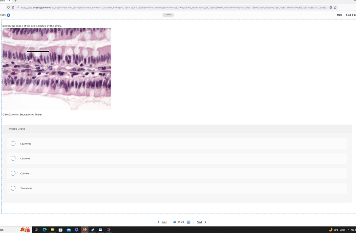 Issues - C
O8 https://ezto.mheducation.com/ext/map/index.html?_con=con&external_browser=0&launchUrl=https%253A%252F%252Fnewconnect.mheducation.com%252F#/activity/question-group/kEZASSBKEPtKtPCm7MmbWfnfHdUVRt6FoM786bP2newkeln 1eMqsVetrOupKMrHTk0kAIMa9i9XGBsihABgCnn_Dgbz58_ *
=suesi
Identify the shape of the cell indicated by the arrow.
Ⓒ McGraw-Hill Education/Al Telser
rch
Multiple Choice
O
Squamous
Columnar
Cuboidal
Transitional
Bi
NO
Saved
< Prev
25 of 35
Next >
Help
35°F Clear
Save & Ex