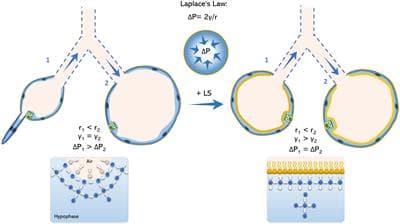 Laplace's Law
AP= Zwr
+ LS
Y. > V2
AP, = AP,
AP, > AP,
