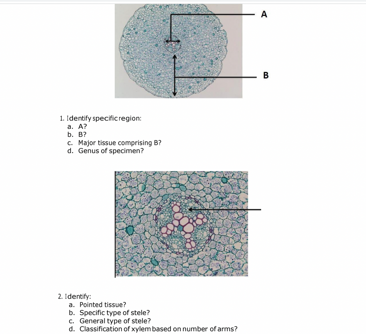 A
В
1. Identify specificregion:
а. А?
b. В?
C. Major tissue comprising B?
d. Genus of specimen?
2. Identify:
a. Pointed tissue?
b. Specific type of stele?
c. General type of stele?
d. Classification of xylem based on number of arms?

