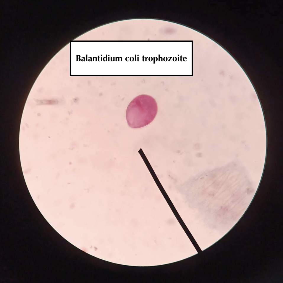 Balantidium coli trophozoite