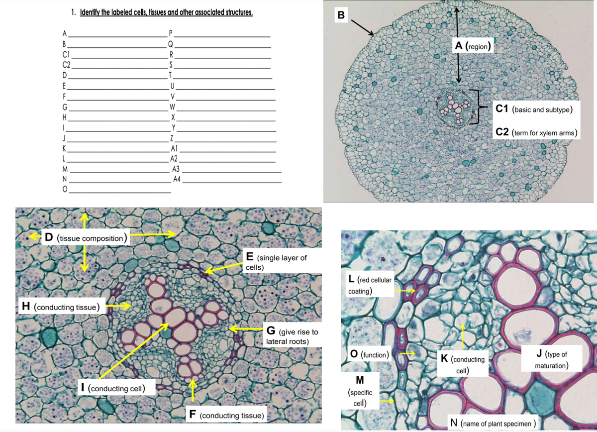 1. Identify the labeled cells, tissues and ofher associated structures.
A
B
Q
A (region)
CI
C2
S
D.
E
F
V
W
C1 (basic and subtype)
H
Y
C2 (term for xylem arms)
K
Al
A2
L
M
АЗ
N
A4
D (tissue composition)
E (single layer of
cells)
L (red cellular
coating)
H (conducting tissue)
G (give rise to
lateral roots)
O (function)
J(уре of
K (conducting
cell)
maturation)
M
I (conducting cell)
(specific
cell)
F (conducting tissue)
N (name of plant specimen )
