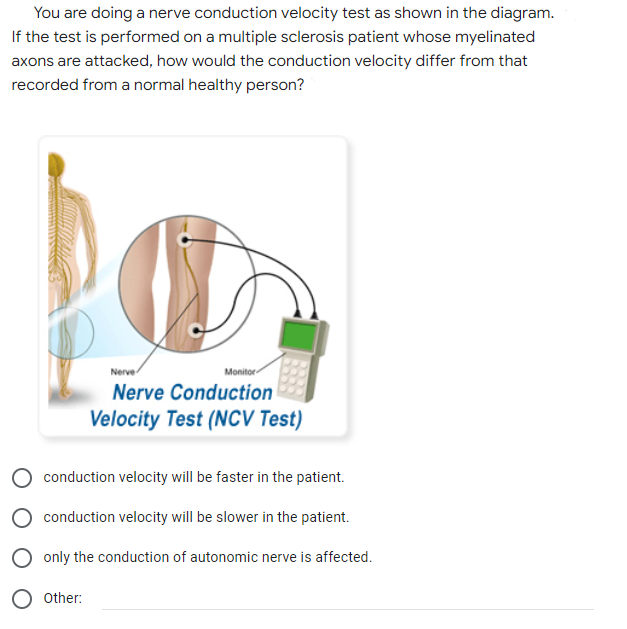 You are doing a nerve conduction velocity test as shown in the diagram.
If the test is performed on a multiple sclerosis patient whose myelinated
axons are attacked, how would the conduction velocity differ from that
recorded from a normal healthy person?
Nerve
Monitor
Nerve Conduction
Velocity Test (NCCV Test)
conduction velocity will be faster in the patient.
conduction velocity will be slower in the patient.
O only the conduction of autonomic nerve is affected.
O other:
