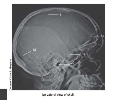 11
|
13
12
14
15
(a) Lateral view of skull.
Courte sy Chaim J. Margolin
