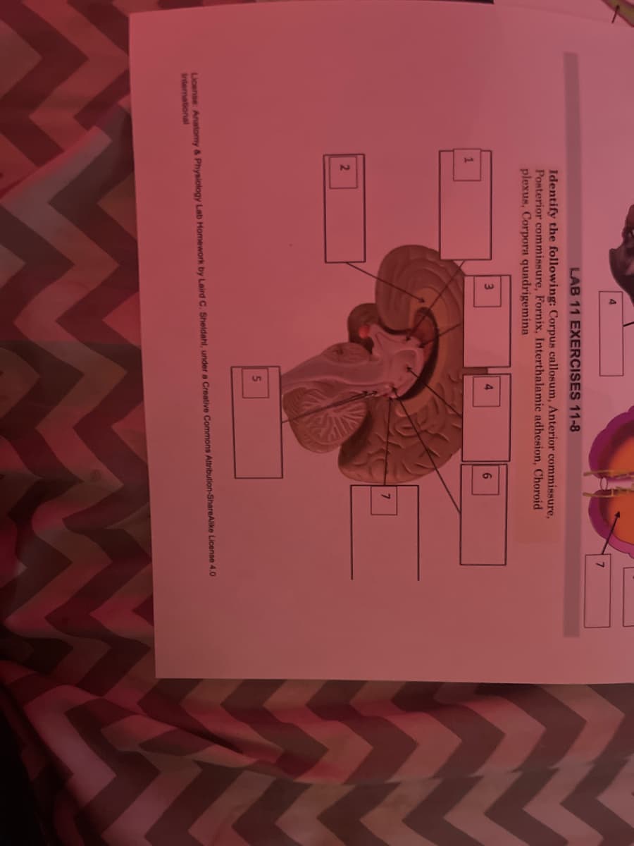 4.
7.
LAB 11 EXERCISES 11-8
Identify the following: Corpus callosum, Anterior commissure,
Posterior commissure, Fornix, Interthalamic adhesion, Choroid
plexus, Corpora quadrigemina
3.
4.
6.
7.
2
5.
License: Anatomy & Physiology Lab Homework by Laird C. Sheldahl, under a Creative Commons Attribution-ShareAlike License 4.0
international
