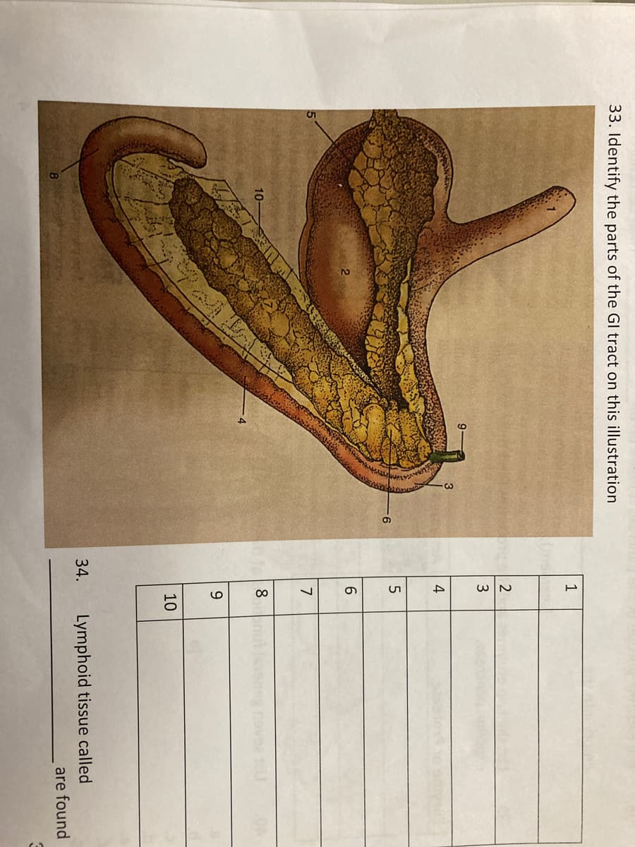 33. Identify the parts of the Gl tract on this illustration
3.
4
6.
7
8.
9.
10
34.
Lymphoid tissue called
are found
