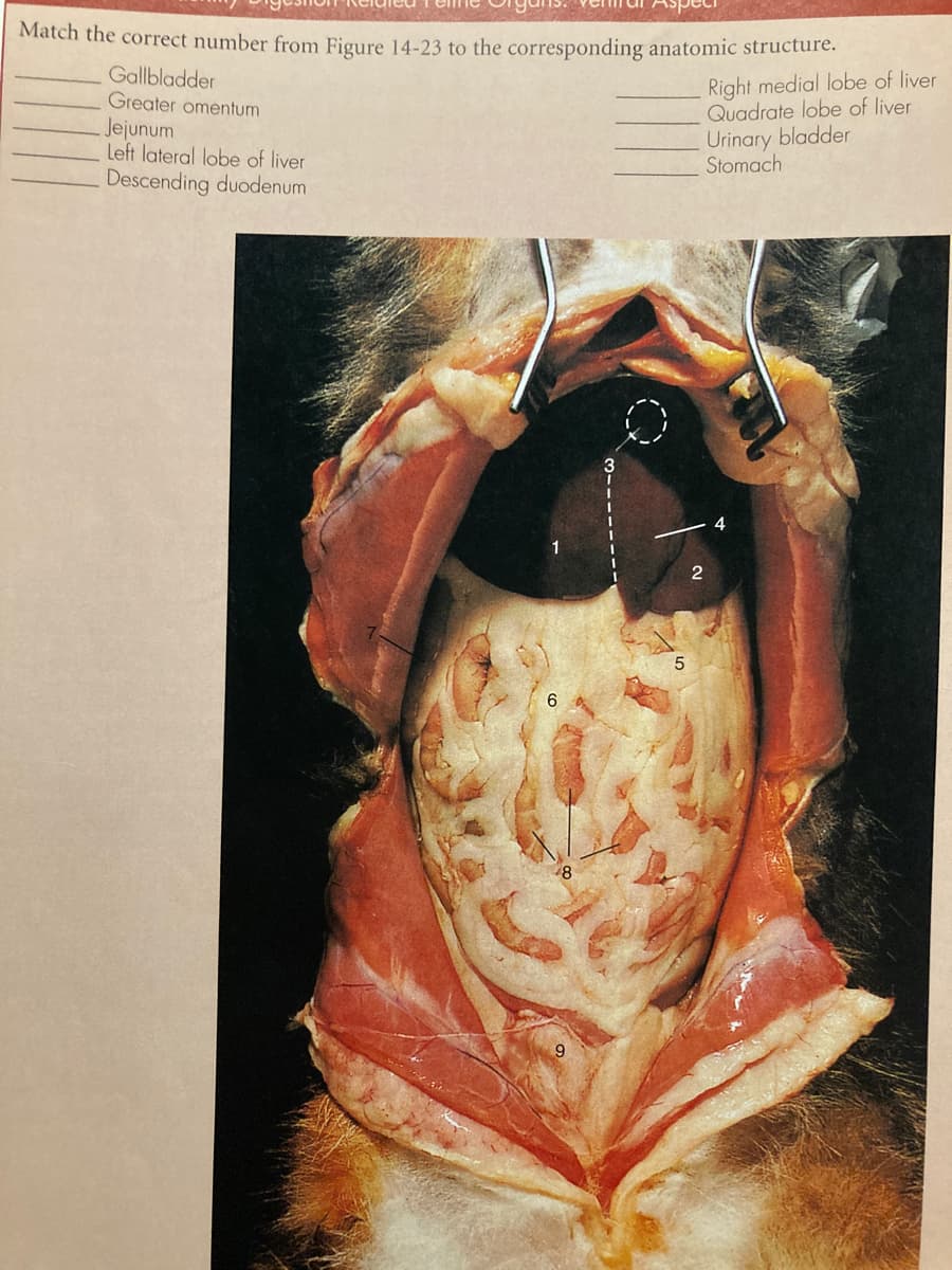 Cidled T eme
Match the correct number from Figure 14-23 to the corresponding anatomic structure.
Gallbladder
Greater omentum
Jejunum
Left lateral lobe of liver
Descending duodenum
Right medial lobe of liver
Quadrate lobe of liver
Urinary bladder
Stomach
2
5
6.
