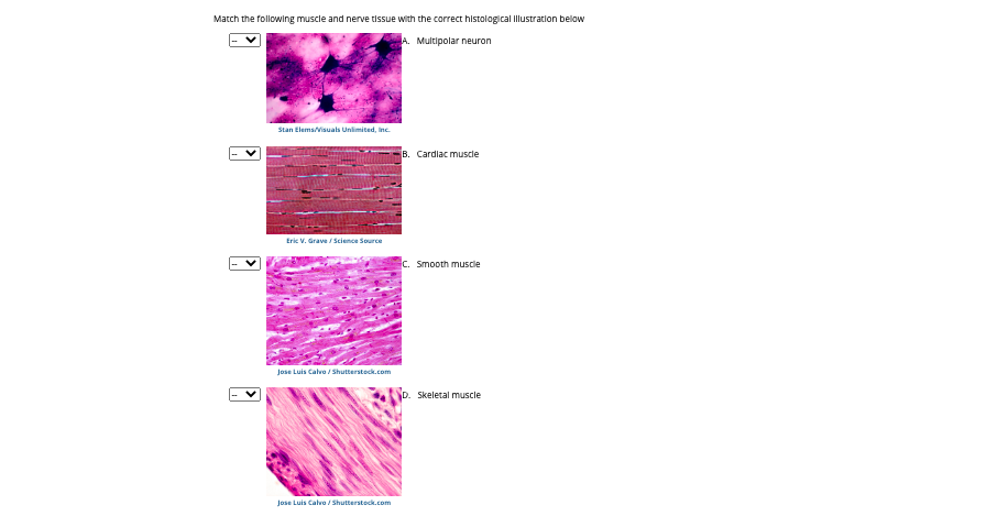 Match the followling muscle and nerve tissue with the correct histological Illustration below
A. Multipolar neuron
Stan Elems/visuals Unlimited, Inc.
B. Cardiac muscie
Eric V. Grave / Science Source
c. Smooth muscle
Jose Luis Calvo / Shutterstock.com
Skeletal muscle
Jose Luis Calvo / Shutterstock.com
