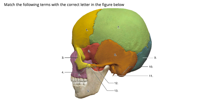 Match the following terms with the correct letter in the figure below
7.
3.
9.
10.
11.
-12.
6.
13.
