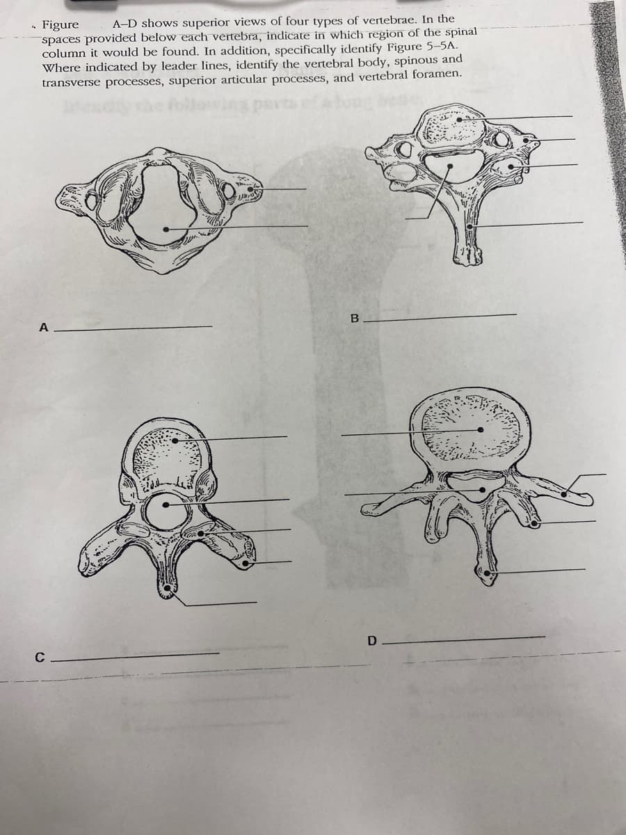 .. Figure A-D shows superior views of four types of vertebrae. In the
spaces provided below each vertebra, indicate in which region of the spinal
column it would be found. In addition, specifically identify Figure 5-5A.
Where indicated by leader lines, identify the vertebral body, spinous and
transverse processes, superior articular processes, and vertebral foramen.
B
D