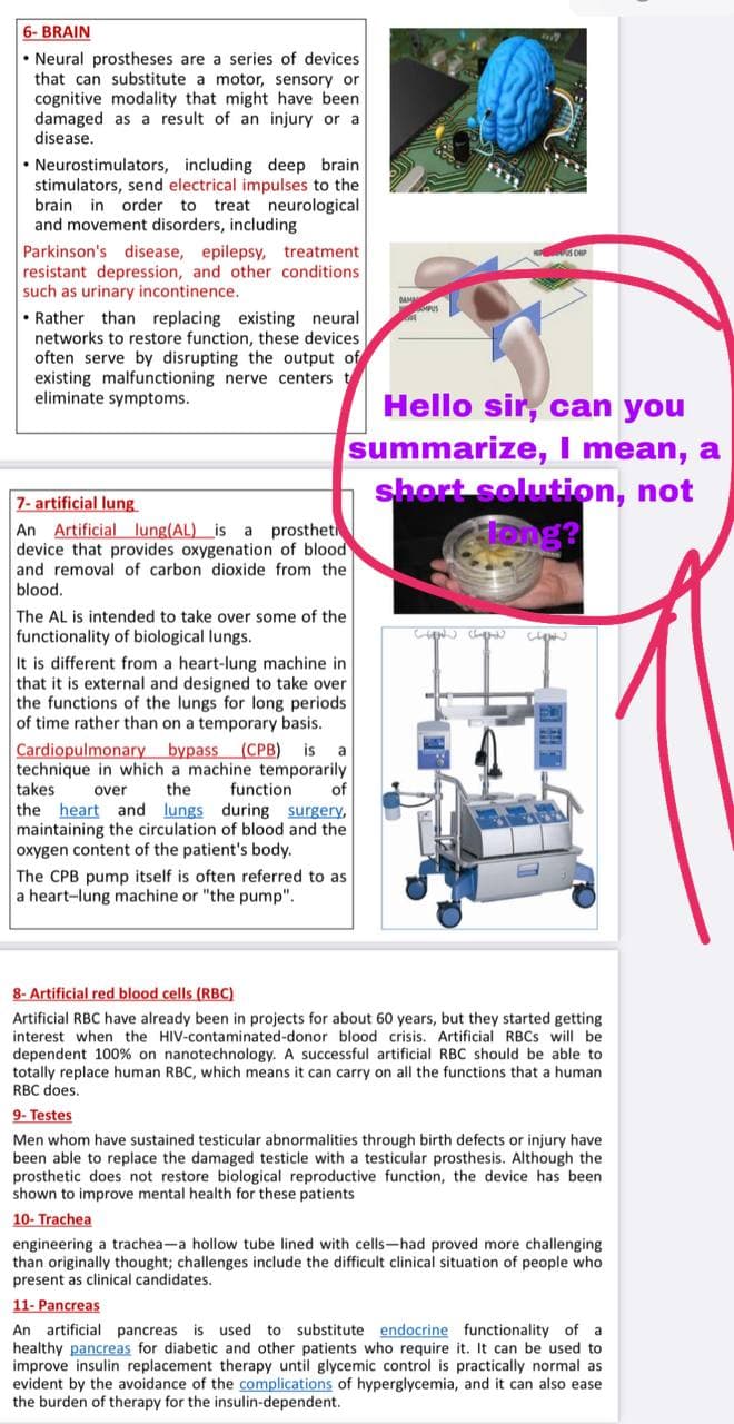 6- BRAIN
• Neural prostheses are a series of devices
that can substitute a motor, sensory or
cognitive modality that might have been
damaged as a result of an injury or a
disease.
• Neurostimulators, including deep brain
stimulators, send electrical impulses to the
brain in order to treat neurological
and movement disorders, including
Parkinson's disease, epilepsy, treatment
resistant depression, and other conditions
such as urinary incontinence.
DAM
• Rather than replacing existing neural
networks to restore function, these devices
often serve by disrupting the output of
existing malfunctioning nerve centers t
eliminate symptoms.
Hello sir, can you
summarize, I mean, a
short solution, not
Png?
7- artificial lung
An Artificial lung(AL) is a prostheti
device that provides oxygenation of blood
and removal of carbon dioxide from the
blood.
The AL is intended to take over some of the
functionality of biological lungs.
It is different from a heart-lung machine in
that it is external and designed to take over
the functions of the lungs for long periods
of time rather than on a temporary basis.
Cardiopulmonary bypass (CPB) is a
technique in which a machine temporarily
takes
the heart and lungs during surgery,
maintaining the circulation of blood and the
oxygen content of the patient's body.
over
the
function
of
The CPB pump itself is often referred to as
a heart-lung machine or "the pump".
8- Artificial red blood cells (RBC)
Artificial RBC have already been in projects for about 60 years, but they started getting
interest when the HIV-contaminated-donor blood crisis. Artificial RBCS will be
dependent 100% on nanotechnology. A successful artificial RBC should be able to
totally replace human RBC, which means it can carry on all the functions that a human
RBC does.
9- Testes
Men whom have sustained testicular abnormalities through birth defects or injury have
been able to replace the damaged testicle with a testicular prosthesis. Although the
prosthetic does not restore biological reproductive function, the device has been
shown to improve mental health for these patients
10- Trachea
engineering a trachea-a hollow tube lined with cells-had proved more challenging
than originally thought; challenges include the difficult clinical situation of people who
present as clinical candidates.
11- Pancreas
An artificial pancreas is used to substitute endocrine functionality of
healthy pancreas for diabetic and other patients who require it. It can be used to
improve insulin replacement therapy until glycemic control is practically normal as
evident by the avoidance of the complications of hyperglycemia, and it can also ease
the burden of therapy for the insulin-dependent.
a
