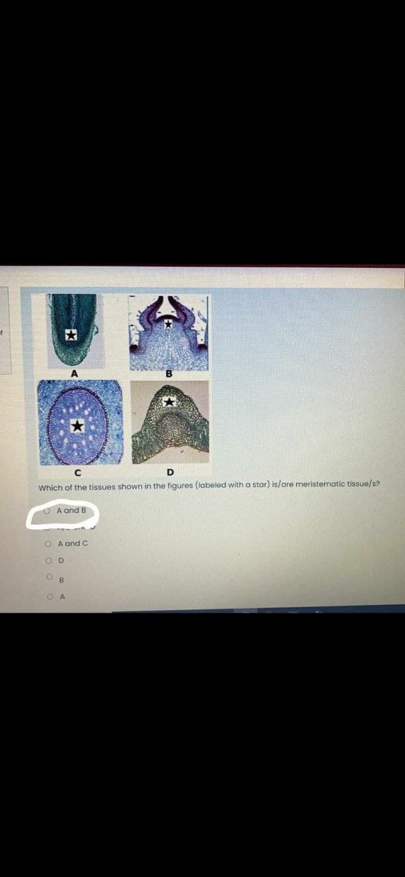 Which of the tissues shown in the figures (labeled with a star) is/are meristematic tissue/s?
A and B
O A and C
O D
B.
O A
