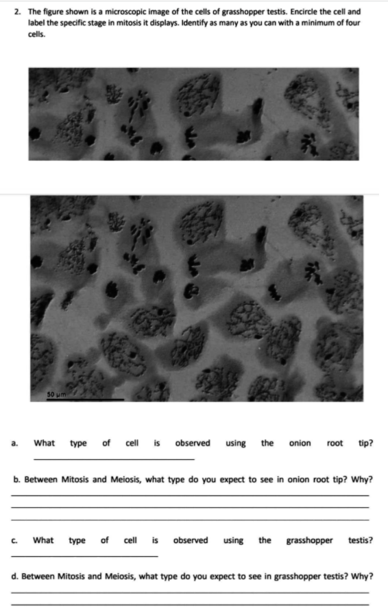 2. The figure shown is a microscopic image of the cells of grasshopper testis. Encircle the cell and
label the specific stage in mitosis it displays. Identify as many as you can with a minimum of four
cells.
50 um
What type
is observed using the onion root tip?
of
cll
b. Between Mitosis and Meiosis, what type do you expect to see in onion root tip? Why?
What
type of cell is observed using the grasshopper
testis?
C.
d. Between Mitosis and Meiosis, what type do you expect to see in grasshopper testis? Why?
