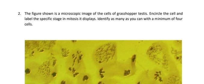 2. The figure shown is a microscopic image of the cells of grasshopper testis. Encircle the cell and
label the specific stage in mitosis it displays. Identify as many as you can with a minimum of four
cells.
