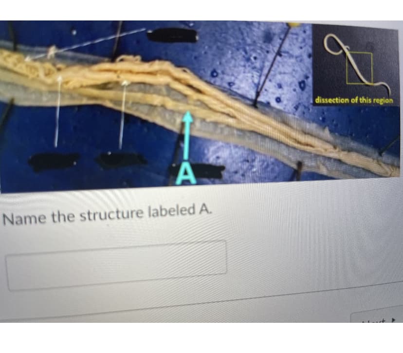 A
Name the structure labeled A.
O
1
dissection of this region