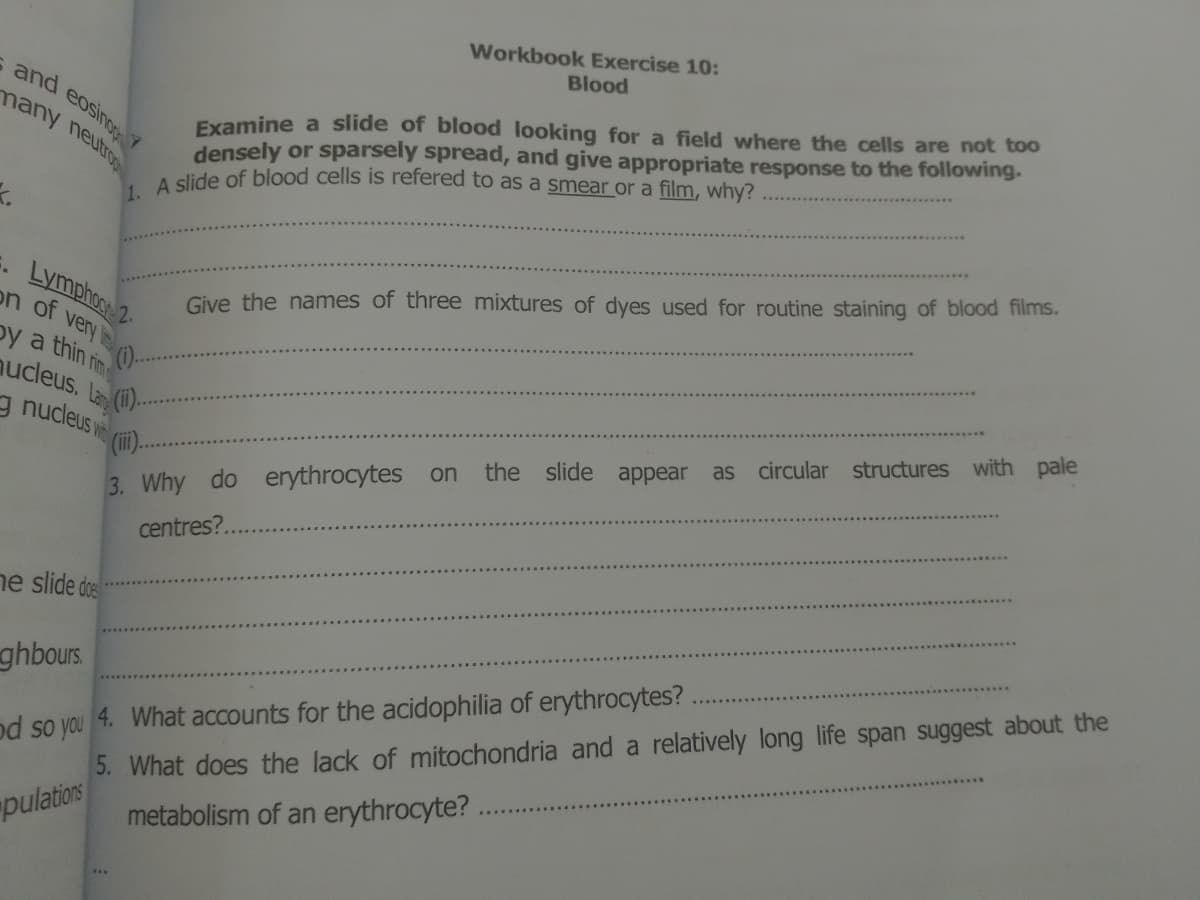 and eu
Workbook Exercise 10:
Blood
Examine a slide of blood looking for a field where the cells are not too
densely or sparsely spread, and give appropriate response to the following.
dide of blood cells is refered to as a smear or a film, why?
. Lymphoe 2
on of very
Give the names of three mixtures of dyes used for routine staining of blood films.
()-
by a thin rim
aucleus.
La (1).
g nucleus w
circular structures with pale
as
the slide appear
3. Why do erythrocytes on
centres?.
ne slide de
od so you
5. What does the lack of mitochondria and a relatively long life span suggest about the
metabolism of an erythrocyte? .
ghbours
4. What accounts for the acidophilia of erythrocytes?
pulations
