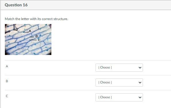 Question 16
Match the letter with its correct structure.
B.
A
[ Choose ]
B
| Choose |
[ Choose
>
