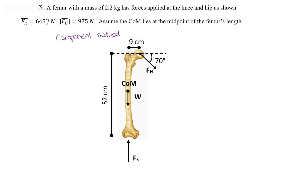 3. A femur with a mass of 2.2 kg has forces applied at the knee and hip as shown
FK = 645N |FH = 975 N. Assume the CoM lies at the midpoint of the femur's length.
Component method
52 cm
૬
9 cm
COM
W
Fk
FH
70°