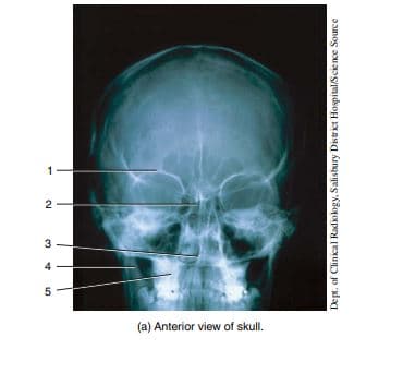 1
2
3
(a) Anterior view of skull.
Dept. of Clinical Radiokogy, Salisbury District Hospital/Science Source
