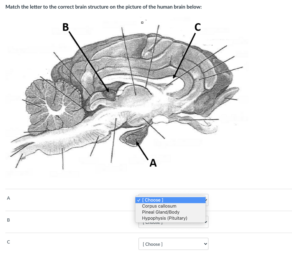 Match the letter to the correct brain structure on the picture of the human brain below:
В
A
V [Choose ]
Corpus callosum
Pineal Gland/Body
Hypophysis (Pituitary)
В
C
[ Choose ]
