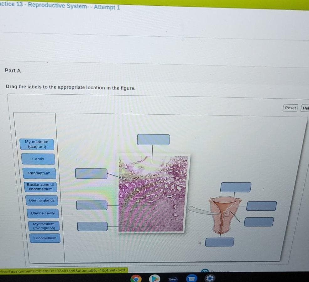 actice 13- Reproductive System- - Attempt 1
Part A
Drag the labels to the appropriate location in the figure.
Reset
Hel
Myometrium
(diagram)
.Cervix
Perimetrium
Basilar zone of
endometrium
Uterine glands
Uterine cavity
Myometrium
(micrograph)
Endometrium
View?assignmentProble
146&attemptNo=1&offset=next
