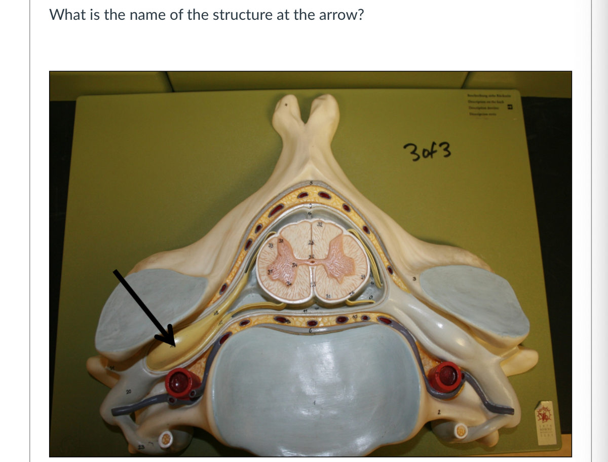 What is the name of the structure at the arrow?
3of3
