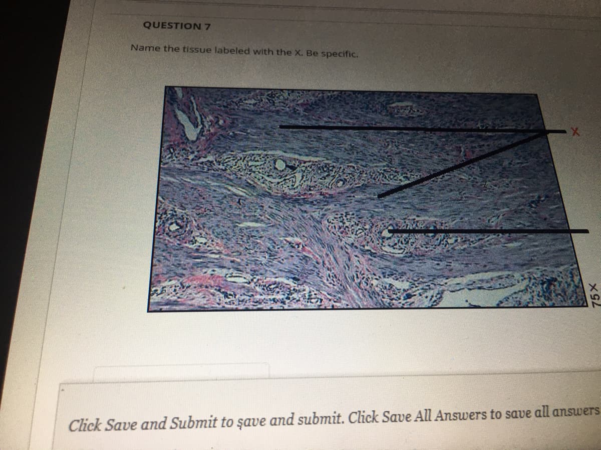 QUESTION 7
Name the tissue labeled with the X. Be specific.
Click Save and Submit to şave and submit. Click Save All Answers to save all answers
