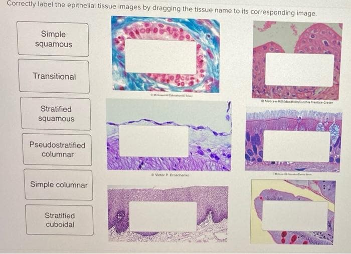 Čorrectly label the epithelial tissue images by dragging the tissue name to its corresponding image.
Simple
squamous
Transitional
Mere
OMIGrew Education/Cynthia Prentice Craver
Stratified
squamous
Pseudostratified
columnar
O Victor P Eroschenko
Simple columnar
Stratified
cuboidal
