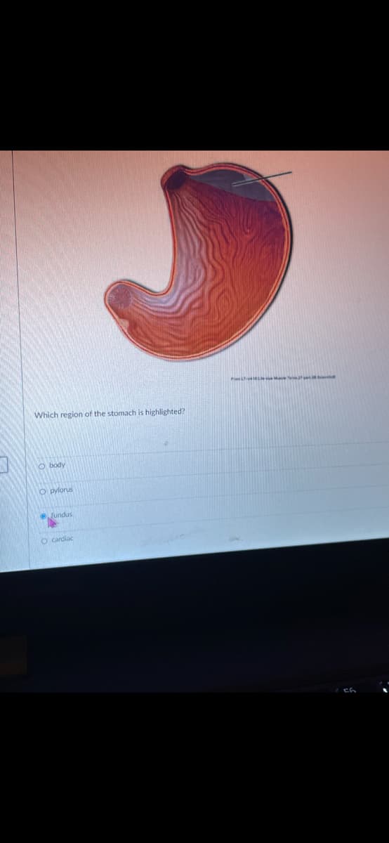 P Ma t
Which region of the stomach is highlighted?
O body
O pylorus
Jundus
O cardiac
