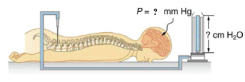 P= ? mm Hg
? cm H₂O