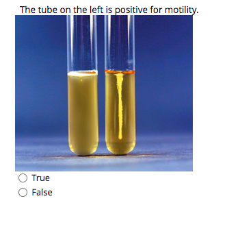 The tube on the left is positive for motility.
O True
O False