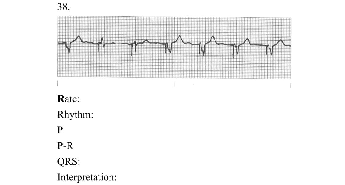 38.
Rate:
Rhythm:
P-R
QRS:
Interpretation:
