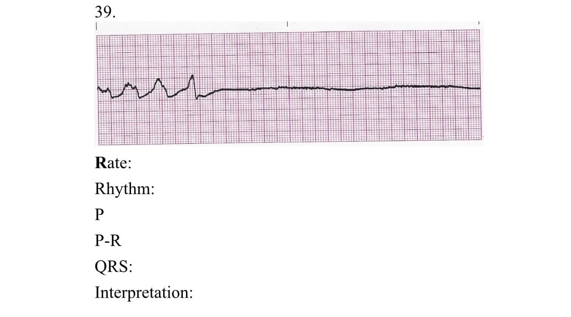 39.
Rate:
Rhythm:
P
P-R
QRS:
Interpretation:
