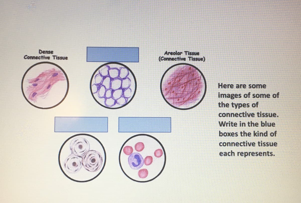 Dense
Connective Tissue
Areolar Tissue
(Connective Tissue)
Here are some
images of some of
the types of
connective tissue.
Write in the blue
boxes the kind of
connective tissue
each represents.