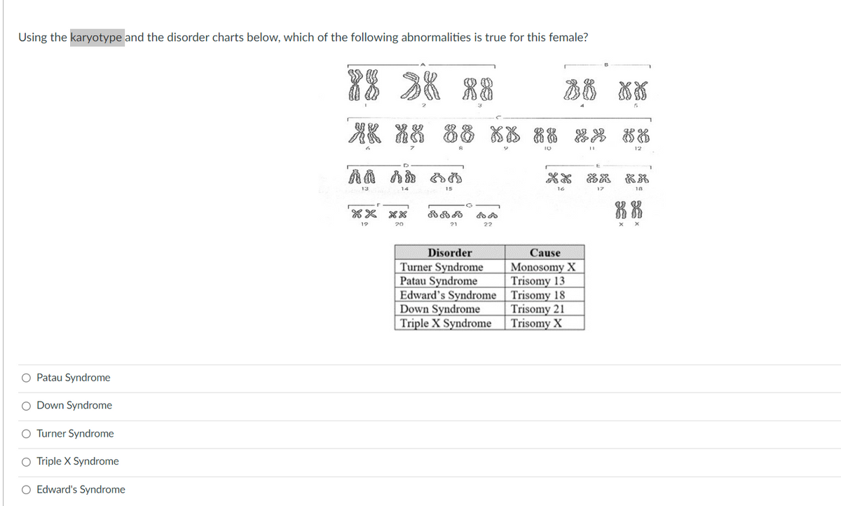 Using the karyotype and the disorder charts below, which of the following abnormalities is true for this female?
88
あ8
AK %8 88 XK
88 器器お品
12
15
18
XX XX
19
20
21
22
Disorder
Cause
Turner Syndrome
Patau Syndrome
Edward's Syndrome
Down Syndrome
Triple X Syndrome
Monosomy X
Trisomy 13
Trisomy 18
Trisomy 21
Trisomy X
O Patau Syndrome
O Down Syndrome
O Turner Syndrome
O Triple X Syndrome
O Edward's Syndrome
