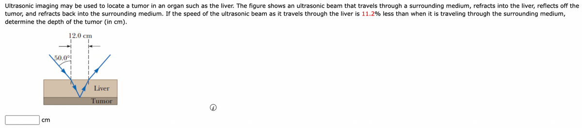 Ultrasonic imaging may be used to locate a tumor in an organ such as the liver. The figure shows an ultrasonic beam that travels through a surrounding medium, refracts into the liver, reflects off the
tumor, and refracts back into the surrounding medium. If the speed of the ultrasonic beam as it travels through the liver is 11.2% less than when it is traveling through the surrounding medium,
determine the depth of the tumor (in cm).
cm
12.0 cm
I
50.0⁰!
Liver
Tumor